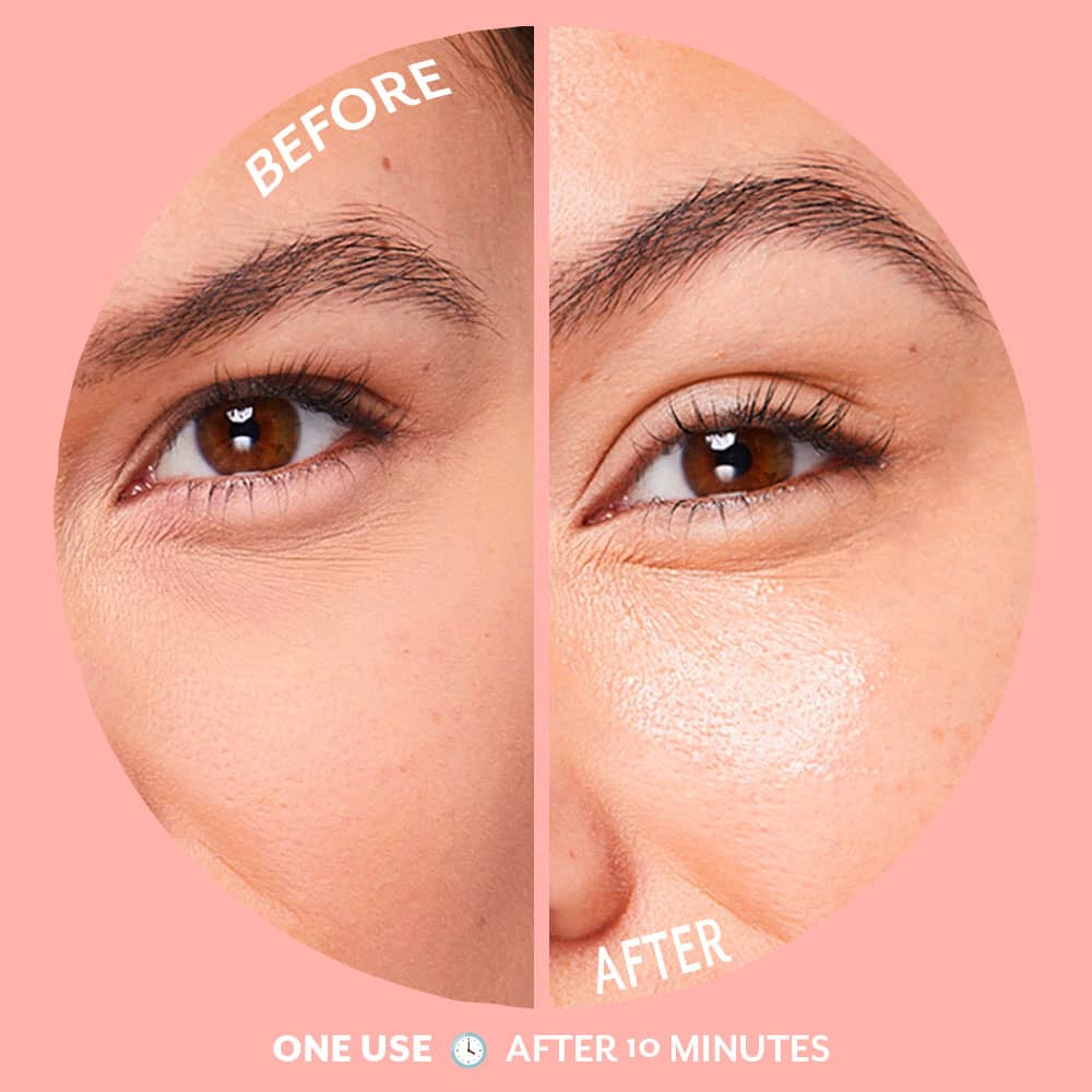 Bubbly Brightening Eye Gels by Patchology